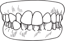 Generally Straight Teeth