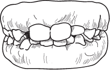 Mix Teeth