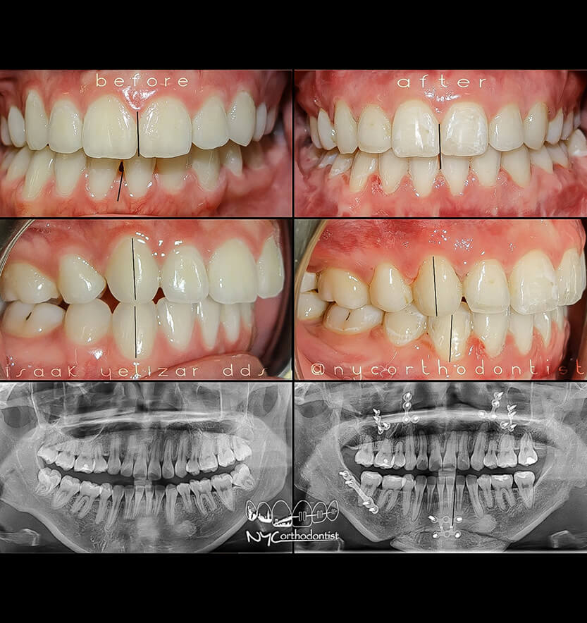 surgical-2-min2