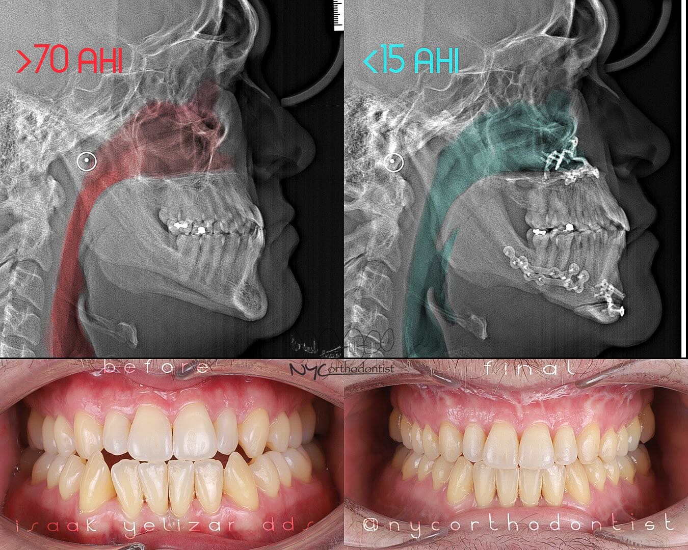 Airway orthodontics in Syosset, NY